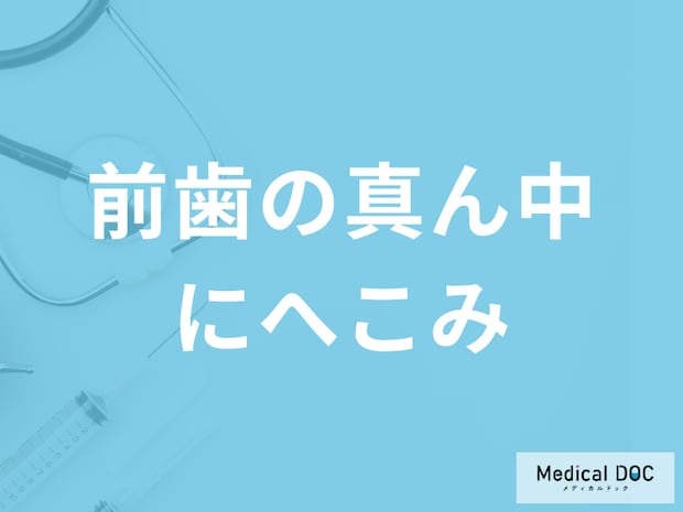 気付かないうちに「前歯の真ん中にへこみ」が…？原因と治療法を解説！