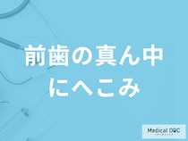 気付かないうちに「前歯の真ん中にへこみ」が…？原因と治療法を解説！