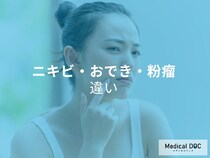 「ニキビ」「おでき」「粉瘤」の違いをご存知ですか? 特徴と見分け方を医師に聞く