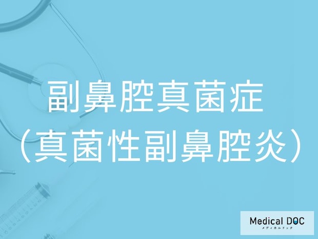 「副鼻腔真菌症」の初期症状をご存じですか？ 鼻づまり・頭痛から見抜くポイントを医師が解説