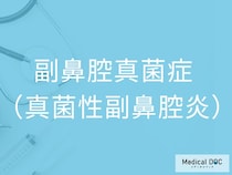 「副鼻腔真菌症」の初期症状をご存じですか？ 鼻づまり・頭痛から見抜くポイントを医師が解説