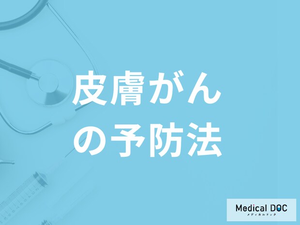 「皮膚がん予防で一番大切なこと」は何かご存じですか?医師が解説!