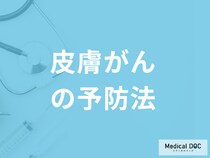 「皮膚がん予防で一番大切なこと」は何かご存じですか？医師が解説！