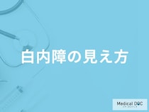 「白内障」を発症するとどんな「見え方」になるかご存知ですか？【医師監修】