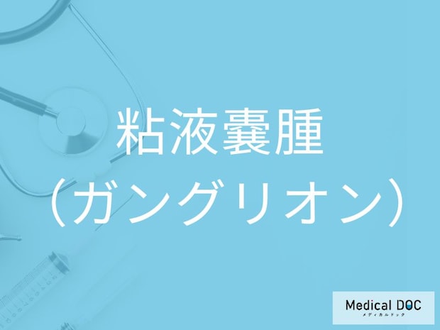 粘液嚢腫（ガングリオン）