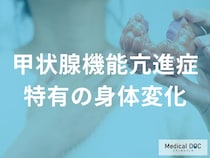 顔つきが変わった？甲状腺ホルモン過剰による目・首・皮膚の変化をチェック
