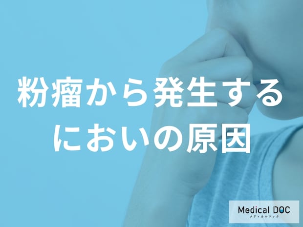 粉瘤の独特なにおいの原因とメカニズム　内容物の成分と対処法を解説