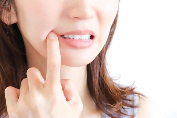 むし歯だらけでも歯列矯正できる？歯列矯正中のむし歯の対処法、予防方法を解説