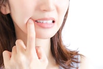 むし歯だらけでも歯列矯正できる？歯列矯正中のむし歯の対処法、予防方法を解説