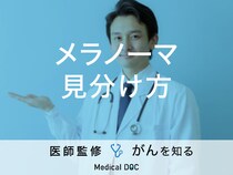 「メラノーマの見分け方」はご存知ですか？発症しないために気をつけることも解説！
