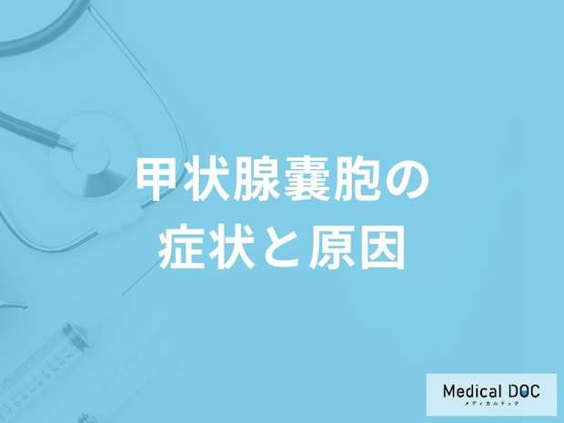 「甲状腺嚢胞」の症状・原因はご存知ですか？【医師監修】