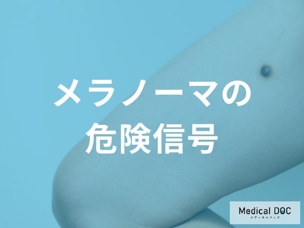 メラノーマの色や形に現れる危険信号？「出血」や「ただれ」は進行のサインかも。