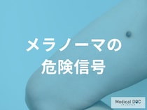 メラノーマの色や形に現れる危険信号？「出血」や「ただれ」は進行のサインかも。