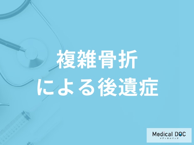 「複雑骨折による後遺症」はご存じですか？予防法も医師が解説！