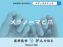「メラノーマ」を発症すると「爪の形や色」はどのように変化する？医師が徹底解説！