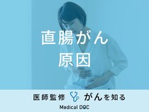「直腸がんの主な5つの原因」はご存知ですか？医師が予防法も徹底解説！
