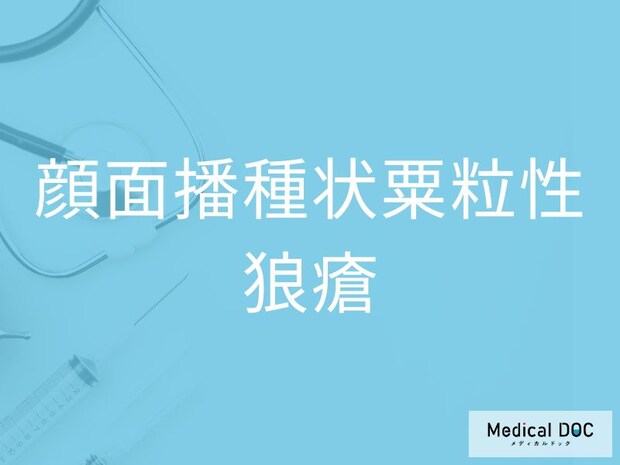 「顔面播種状粟粒性狼瘡」の原因とは 毛包炎症と肉芽腫形成の関係を医師が解説