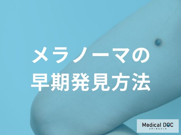 背中や頭皮は大丈夫?見えにくい場所のメラノーマを見つけるコツを医師が解説