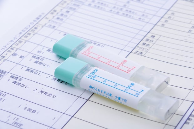 便潜血検査と大腸カメラの選び方と受診の目安