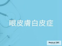 「眼皮膚白皮症」の合併症リスクを医師が解説 皮膚がん予防のためにできることとは