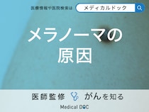 「メラノーマの原因」はご存知ですか？なりやすい人の特徴も解説！【医師監修】