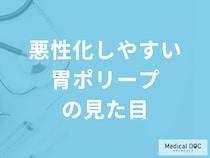 ”悪性化”しやすい「胃ポリープの見た目」は？進行時の症状も医師が解説！