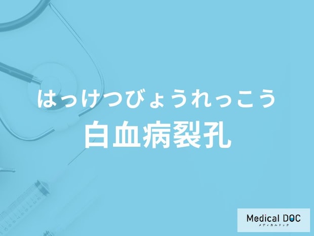 「白血病裂孔」の主な症状・原因はご存知ですか？医師が徹底解説！