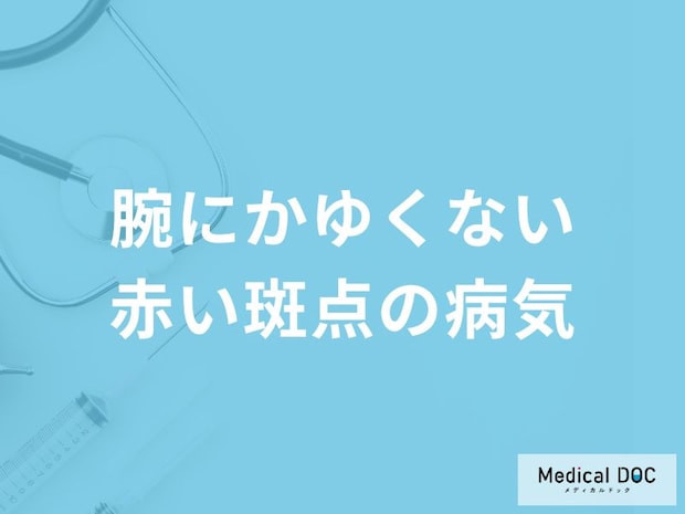 「腕にかゆくない赤い斑点」ができるとどんな「病気」が考えられる？医師が徹底解説！