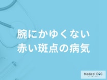 「腕にかゆくない赤い斑点」ができるとどんな「病気」が考えられる？医師が徹底解説！
