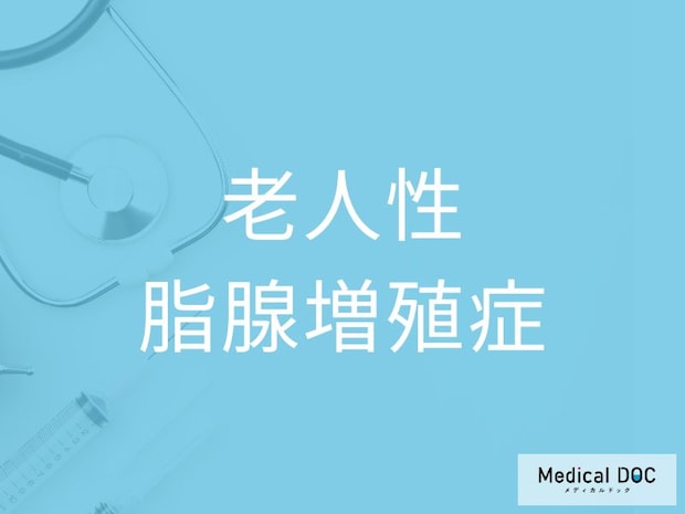 加齢とともに増えやすい！ 「老人性脂腺増殖症」になりやすい人と対処法を医師が解説