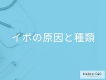 「イボの症状」はご存じですか？意外と知らない原因や感染の有無も医師が解説！