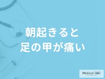 「朝起きると足の甲が痛い」のは扁平足が原因？対処法についても医師が解説！