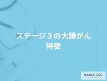 「ステージ3の大腸がんの特徴」はご存知ですか？医師が解説！