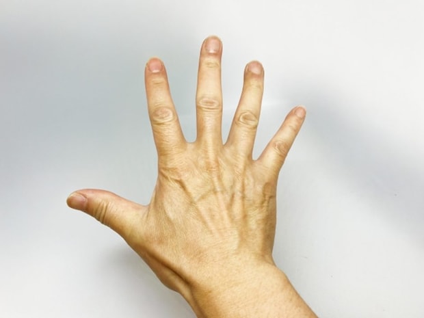 手の甲にできる発疹と梅毒の関係