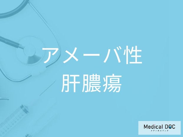 放置すると重症化も！ 「アメーバ性肝膿瘍」の経過と合併症リスクを医師に聞く
