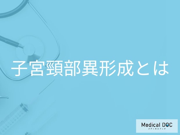 子宮頸がん検診で「異形成」と指摘されたら? がん化するまでの期間と進行度別リスク【医師解説】