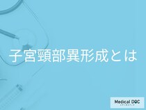 子宮頸がん検診で「異形成」と指摘されたら? がん化するまでの期間と進行度別リスク【医師解説】