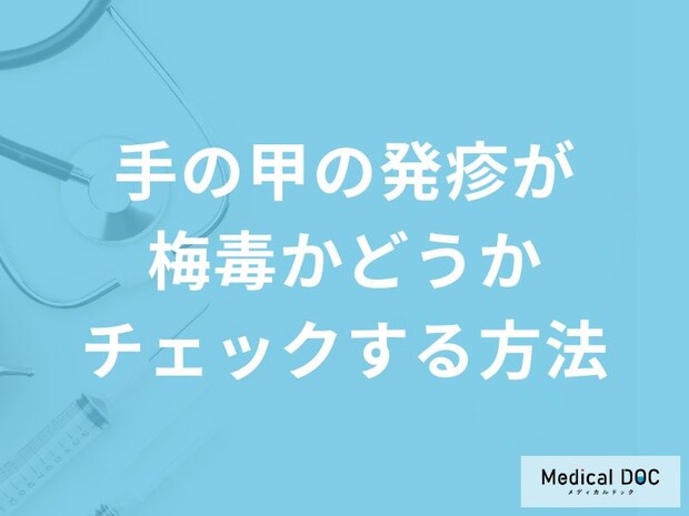 「手の甲に出来た発疹」にどのような特徴があれば「梅毒」を疑った方がいい？【医師監修】