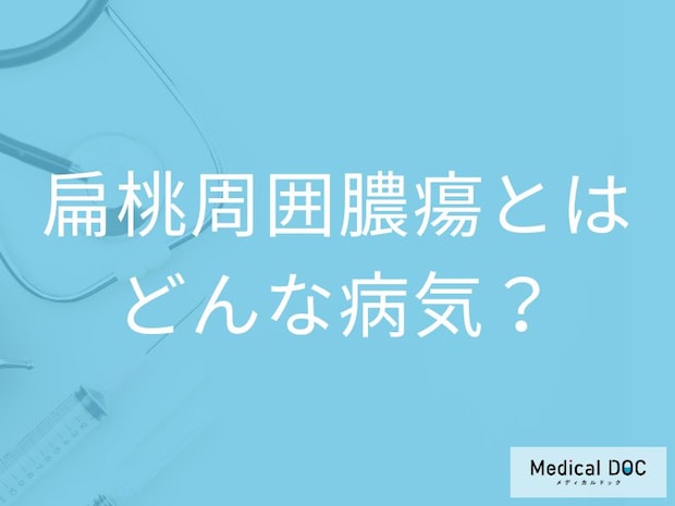 ”唾が飲めない喉の痛み”は扁桃周囲膿瘍のサイン？原因や発症しやすい人も医師が解説！