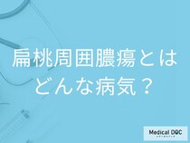 ”唾が飲めない喉の痛み”は扁桃周囲膿瘍のサイン？原因や発症しやすい人も医師が解説！