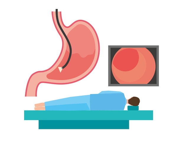 ピロリ菌除菌後も内視鏡検査が必要な理由とは