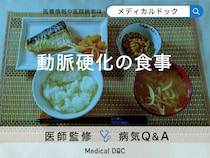 「動脈硬化の予防」が期待できる「食品」はご存知ですか？【医師監修】