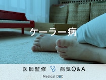 「ケーラー病」になると現れる症状はご存知ですか？