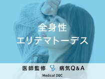 「全身性エリテマトーデス（SLE）（指定難病49）」の初期症状はご存知ですか？
