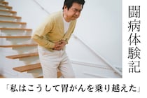 【闘病記】「私の胃がんは初期症状全くなし」胃カメラで発見できた