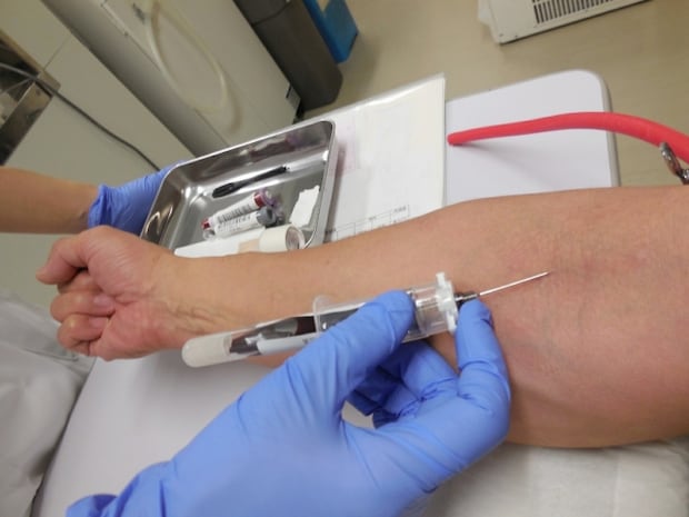 無症状のまま人間ドックで発見される