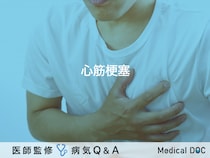 「心筋梗塞」とは？症状・原因・兆候についても解説！【医師監修】
