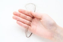 【闘病】なぜ『乳がん』に？ 落ちていく“涙”と「毛髪」は抗がん剤の副作用…