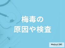 「梅毒の原因」はご存知ですか？潜伏期間や検査法も解説！【医師監修】