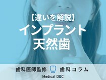 『天然歯とインプラントの違い』をご存知ですか？ メンテナンス方法も歯科医師が解説！
